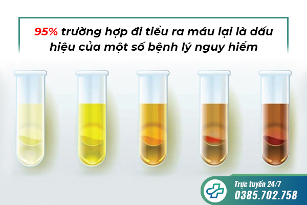 Tiểu ra máu ở nam giới và những điều cần biết