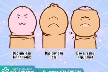 Tìm hiểu về cắt bao quy đầu từ A- Z : Lợi ích, Quy trình, Chi phí, Chăm sóc