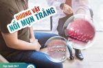 Nổi mụn trắng ở bao quy đầu – Cảnh báo nhiều bệnh lý nguy hiểm