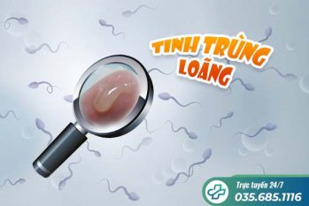 Tinh trùng loãng – Nguyên nhân, triệu chứng và cách điều trị