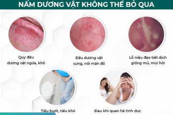 Nấm dương vật: Gây ung thư nếu không điều trị kịp thời