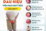 [ Chuyên gia y tế chia sẻ] Viêm bao quy đầu gây nên những tác hại gì?
