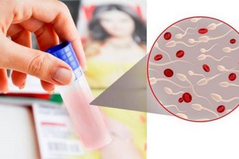 Đa khoa Quốc Tế Khang Thịnh – Địa chỉ hỗ trợ điều trị xuất tinh ra máu tại HCM uy tín