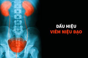 Viêm niệu đạo ở nam: Nguyên nhân, triệu chứng và cách điều trị