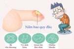 Mách bạn 6+ nguyên nhân nấm bao quy đầu thường gặp