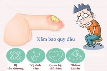 Tác hại nấm bao quy đầu khi không điều trị kịp thời