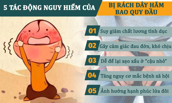 Rách dây hãm bao quy đầu: Nguyên nhân và phương pháp điều trị