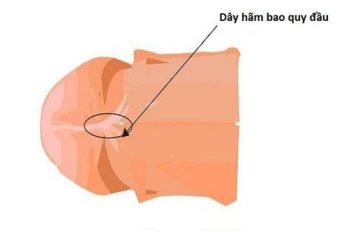 Dây hãm bao quy đầu bị sưng: Cách xử lý hiệu quả