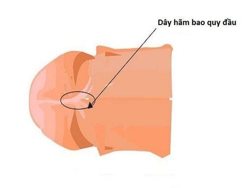 Dây hãm bao quy đầu bị sưng: Cách xử lý hiệu quả
