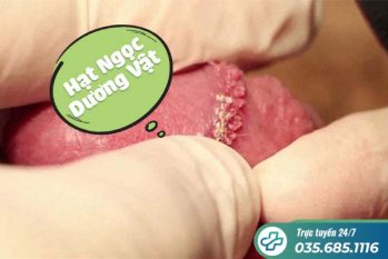 Hạt ngọc dương vật và những điều nam giới cần biết