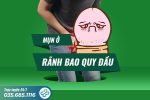 Mụn ở rãnh bao quy đầu: Nguyên nhân và cách điều trị hiệu quả