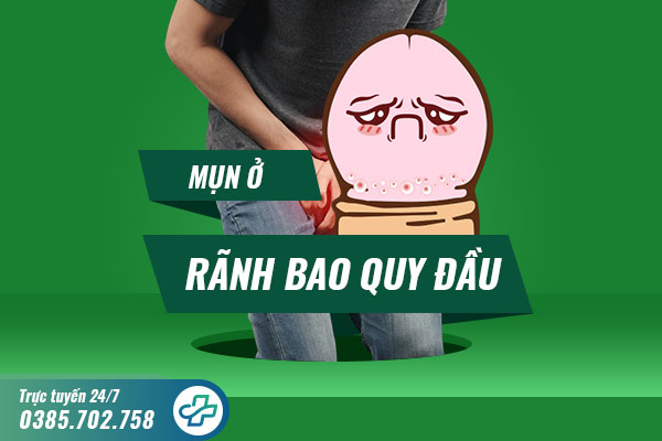 Mụn ở rãnh bao quy đầu: Nguyên nhân và cách điều trị hiệu quả