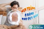 Mụn trắng ở rãnh bao quy đầu là bệnh gì?