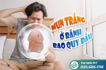 Mụn trắng ở rãnh bao quy đầu là bệnh gì?