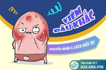 Viêm đầu khấc: Nguyên nhân và cách điều trị