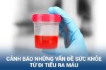 Phòng Khám Đa Khoa HCM – Điều trị khỏi bệnh tiểu ra máu bằng hệ thống CRS