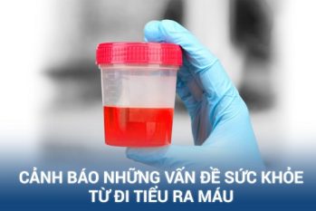 Phòng Khám Đa Khoa HCM – Điều trị khỏi bệnh tiểu ra máu bằng hệ thống CRS