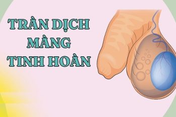 Tràn dịch tinh hoàn: Nguyên nhân, triệu chứng và chi phí điều trị hiện nay