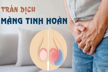 Cảnh báo tràn dịch màng tinh hoàn ở người lớn – Đừng chờ đến khi quá muộn!
