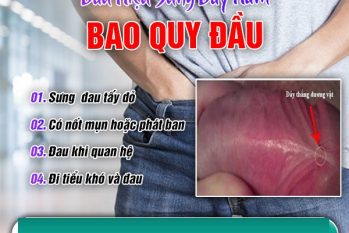 Dây thắng dương vật bị sưng: Dấu hiệu nguy hiểm không thể bỏ qua!