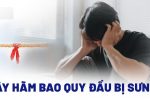 Dây thắng dương vật sưng đau: Nguyên nhân và cách chữa trị hiệu quả!