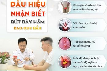 Dây hãm quy đầu bị đứt: Dấu hiệu nhận biết và cách xử lý an toàn