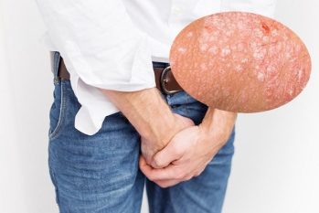 Dái bị ngứa, nổi mụn: Nguyên nhân và cách điều trị hiệu quả tại Phòng Khám Đa Khoa HCM
