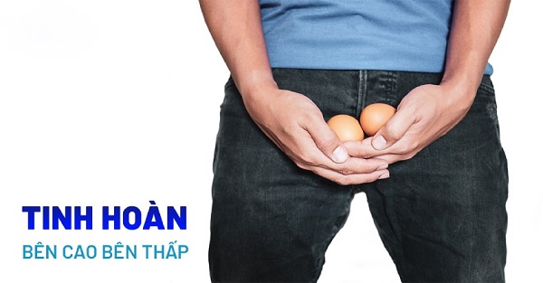 Tinh hoàn bên cao bên thấp có sao không, có bị vô sinh không?