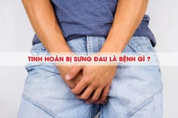 Tinh Hoàn Sưng To: Tổng Hợp Các Bệnh Lý Có Thể Gặp Phải