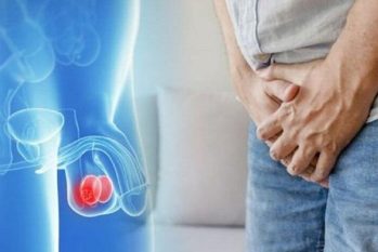 Tinh hoàn nổi hạch – Cảnh báo u tinh hoàn và cách điều trị hiệu quả