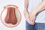 Tinh hoàn bị xệ – Dấu hiệu không thể xem nhẹ, nam giới cần chủ động kiểm tra sớm