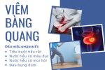 Khám viêm bàng quang ở đâu tốt tại TPHCM? Gợi ý địa chỉ uy tín, bác sĩ tận tâm”