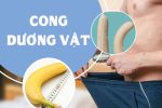 Dương vật bị cong phải làm sao? Bật mí cách khắc phục hiệu quả