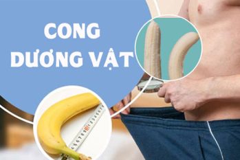 Dương vật bị cong phải làm sao? Bật mí cách khắc phục hiệu quả