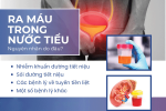 Tình trạng nước tiểu có máu – Do nguyên nhân nào?