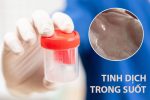 Tinh dịch trong suốt: Triệu chứng bất thường và cách cải thiện hiệu quả