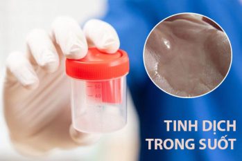 Tinh dịch trong suốt: Triệu chứng bất thường và cách cải thiện hiệu quả
