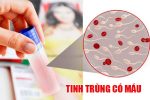 Hoảng hốt vì tinh dịch có máu? Chuyên gia giải thích lý do và hướng điều trị