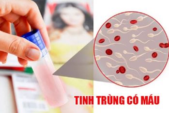Hoảng hốt vì tinh dịch có máu? Chuyên gia giải thích lý do và hướng điều trị