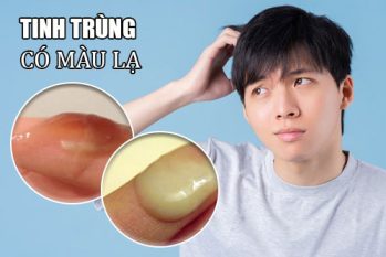 Đừng bỏ qua nếu tinh dịch có màu khác lạ – Cảnh báo bệnh lý nam khoa