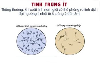 Cách nhận biết và khắc phục tình trạng tinh dịch ít ở nam giới