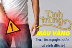 Nam giới đừng chủ quan khi thấy tinh dịch màu vàng – Đây là lý do!