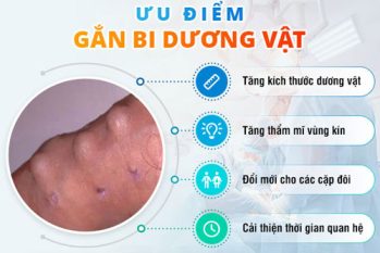Gắn bi dương vật giúp gì cho đời sống tình dục? Top những ưu điểm nổi bật